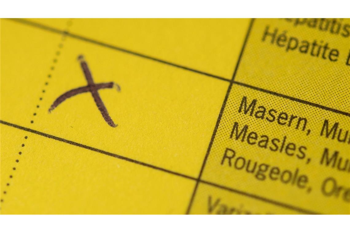 Masernausbruch - 16 Menschen erkrankt In Karlsruhe ist es zu einem Masernausbruch gekommen. (Symbolbild)