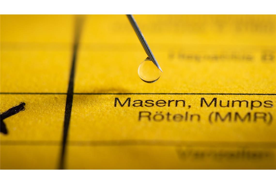 In Karlsruhe ist es zu einem Masernausbruch gekommen. (Symbolbild)