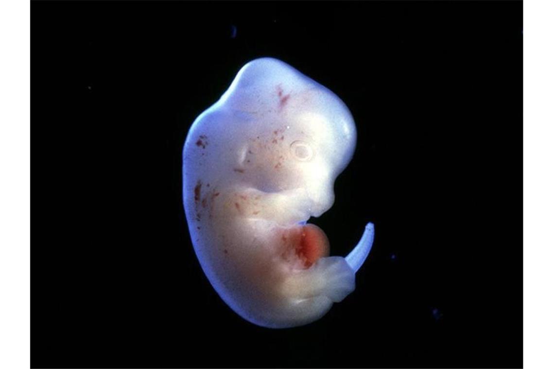 Japanische Forscher wollen menschliche Organe in Tieren züchten - wie etwa in einem Rattenembryo. Foto: Science Pictures ltd/SPL