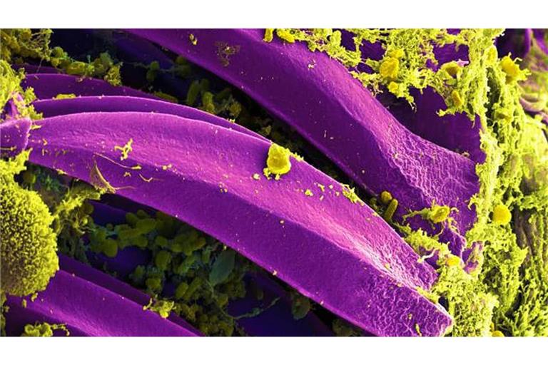 Kleiner Erreger, große Wirkung: Yersinia-pestis-Bakterium unter dem Elektronenmikroskop.