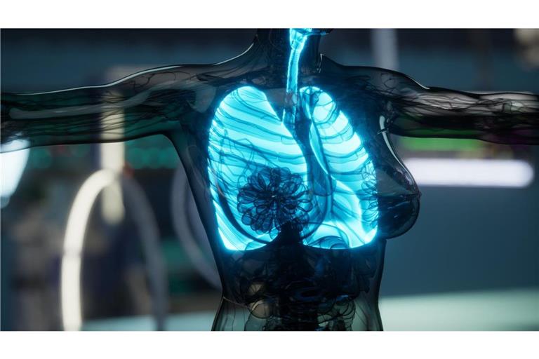 Laut Forschern kann ein schwerer Verlauf von Covid-19 oder Grippe die Lunge in einen langanhaltenden Entzündungszustand versetzen, der es Krebs später erleichtert, sich dort anzusiedeln.