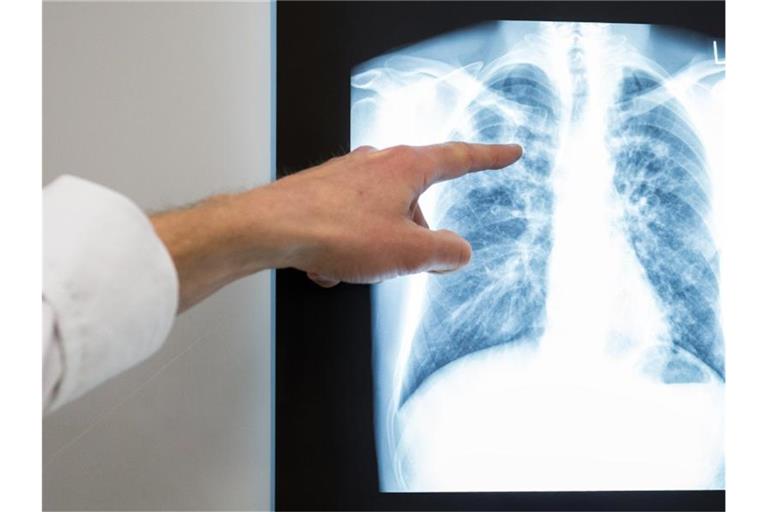 Mehr als hundert Lungenspezialisten bezweifeln den gesundheitlichen Nutzen der aktuellen Grenzwerte für Feinstaub und Stickoxide (NOx). Foto: Silas Stein