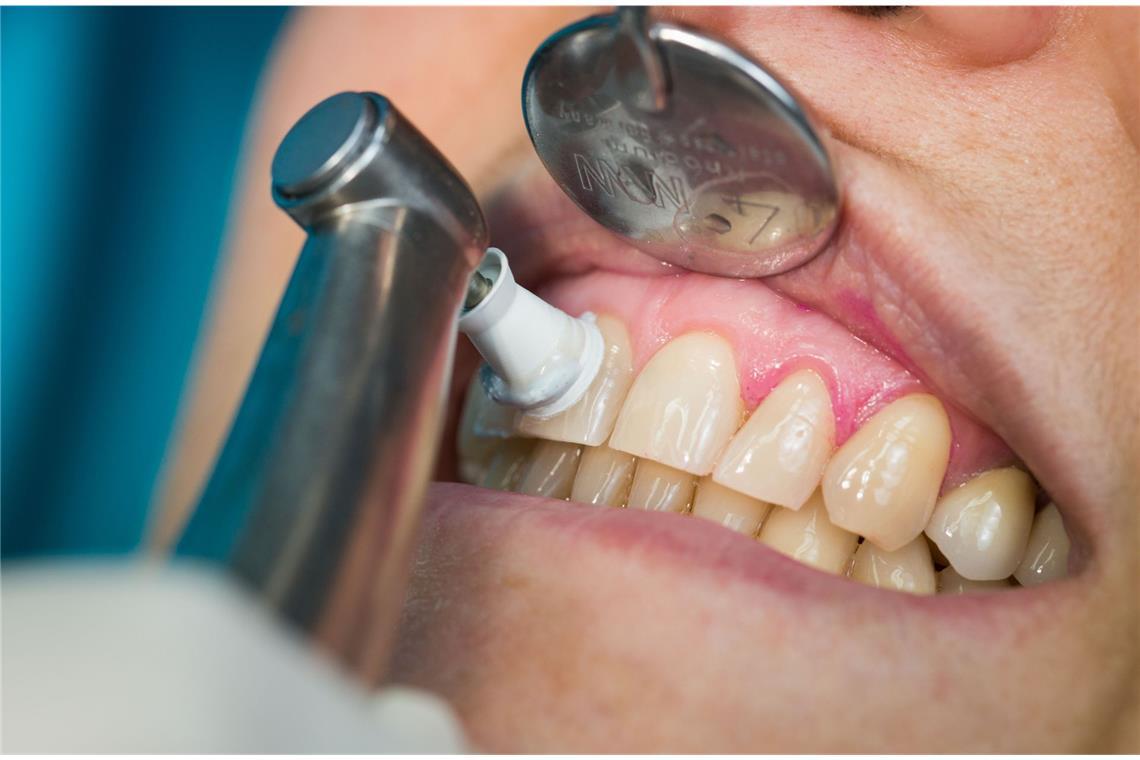 Menschenbisse gelten als gefährlicher als die vieler Tiere. Ursache sind potenziell gefährliche Bakterien aus der menschlichen Mundflora, die übertragen werden können – vor allem  Streptokokken oder Staphylococcus aureus.