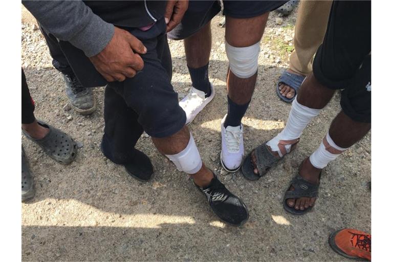 Migranten aus Pakistan zeigen Verletzungen an den Beinen. Foto: Gregor Mayer/dpa