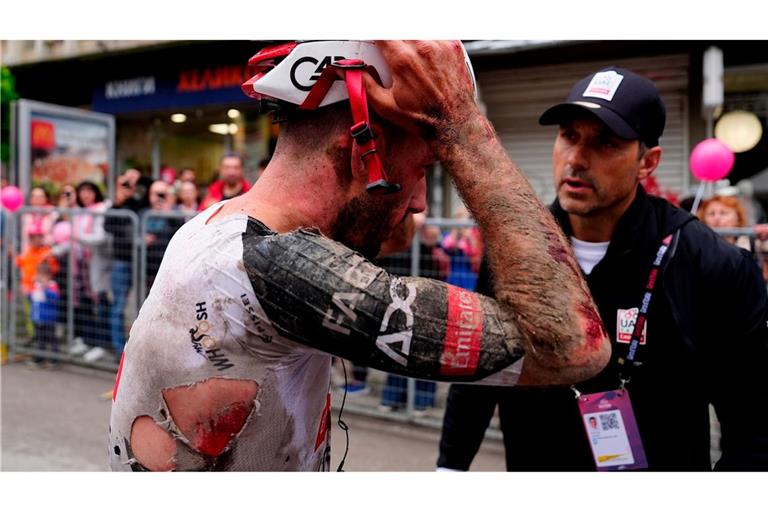 Mitfavorit Adam Yates stürzte beim Giro d'Italia schwer.