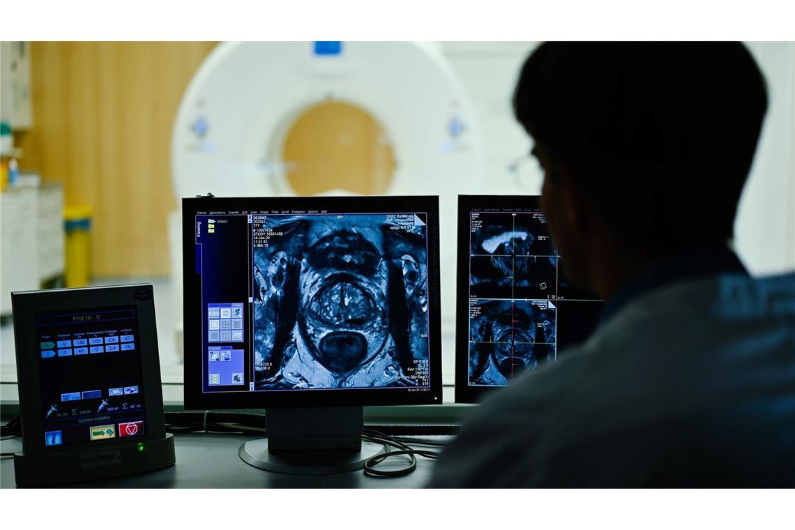 Globale Studie: Vier von zehn Krebstodesfällen vermeidbar Nach dem Anfangsverdacht auf Prostatakrebs kommen im Verlauf einer Diagnostik auch bildgebende Verfahren zum Einsatz. (Archivbild)