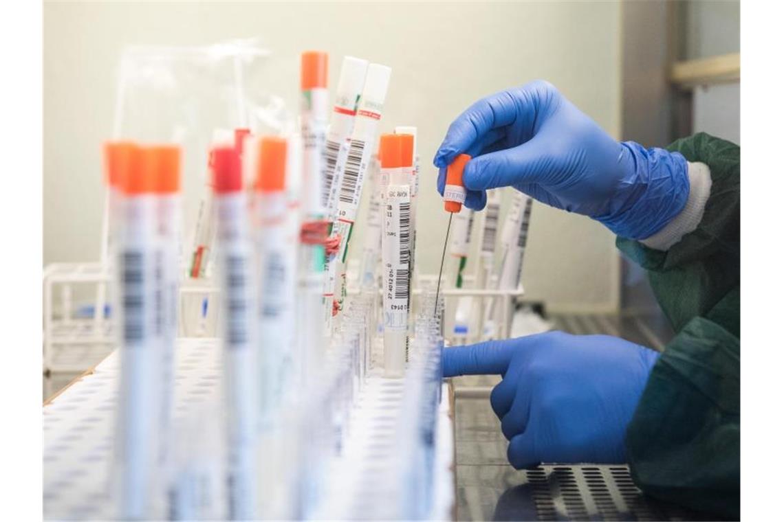 Labore warnen vor Überlastung durch immer mehr Corona-Tests Nach Verbandsangaben sind die Testkapazitäten der Labore erstmals zu 100 Prozent ausgereizt. Foto: Daniel Bockwoldt/dpa