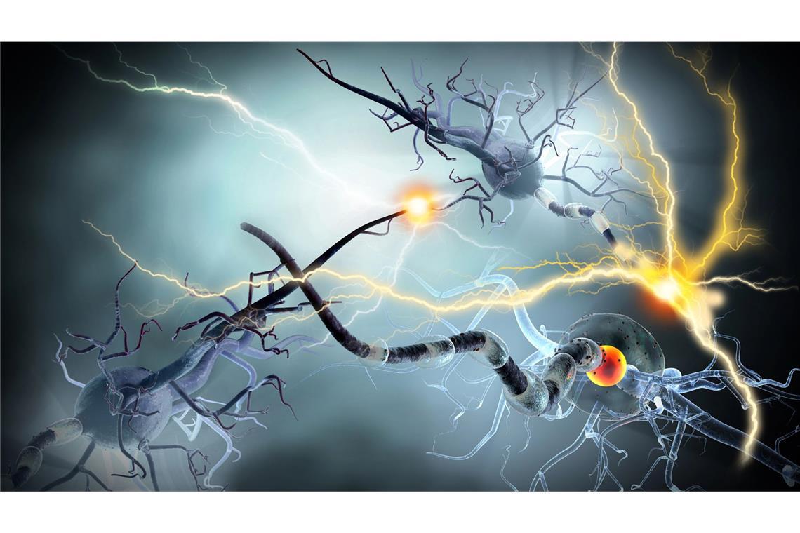 So sehen menschliche Nervenzellen in Wirklichkeit aus Nervenbahnen sind komplexer, als wir dachten: Forscher haben eine perlenartige Struktur aufgedeckt, die vielleicht entscheidend fürs Denken und neurologische Erkrankungen ist.