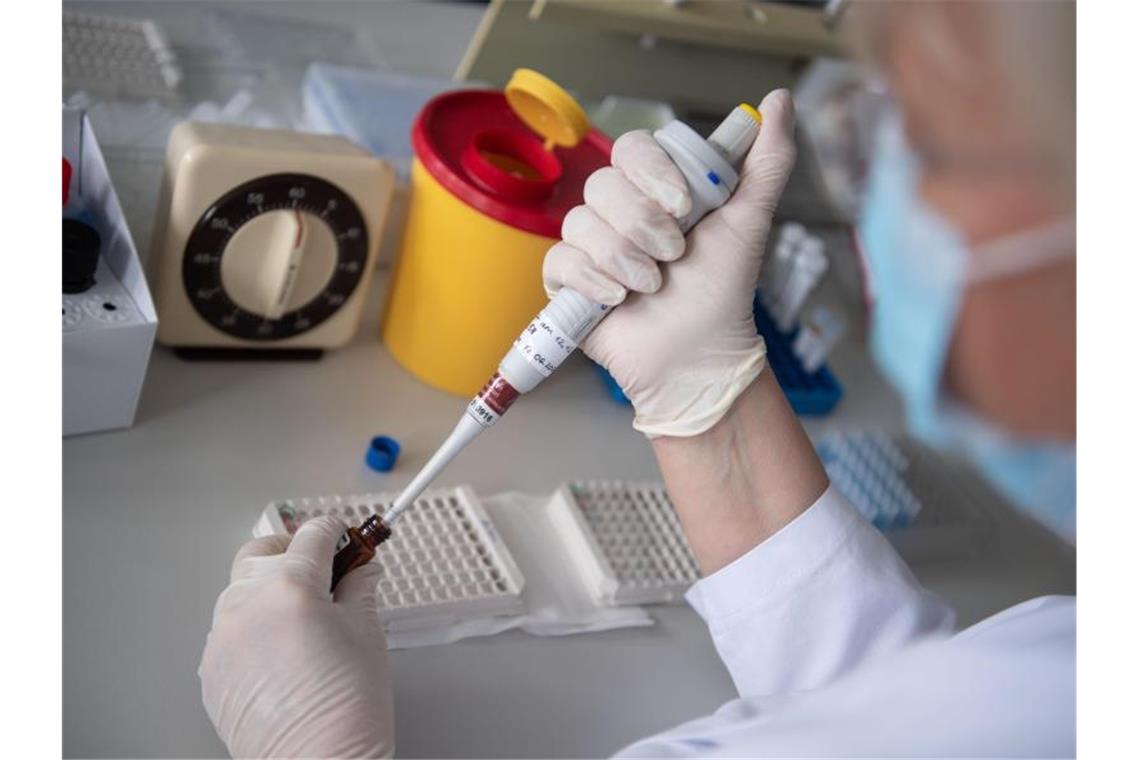Sinkende Antikörperzahl dämpft Hoffnung auf Impfstoff