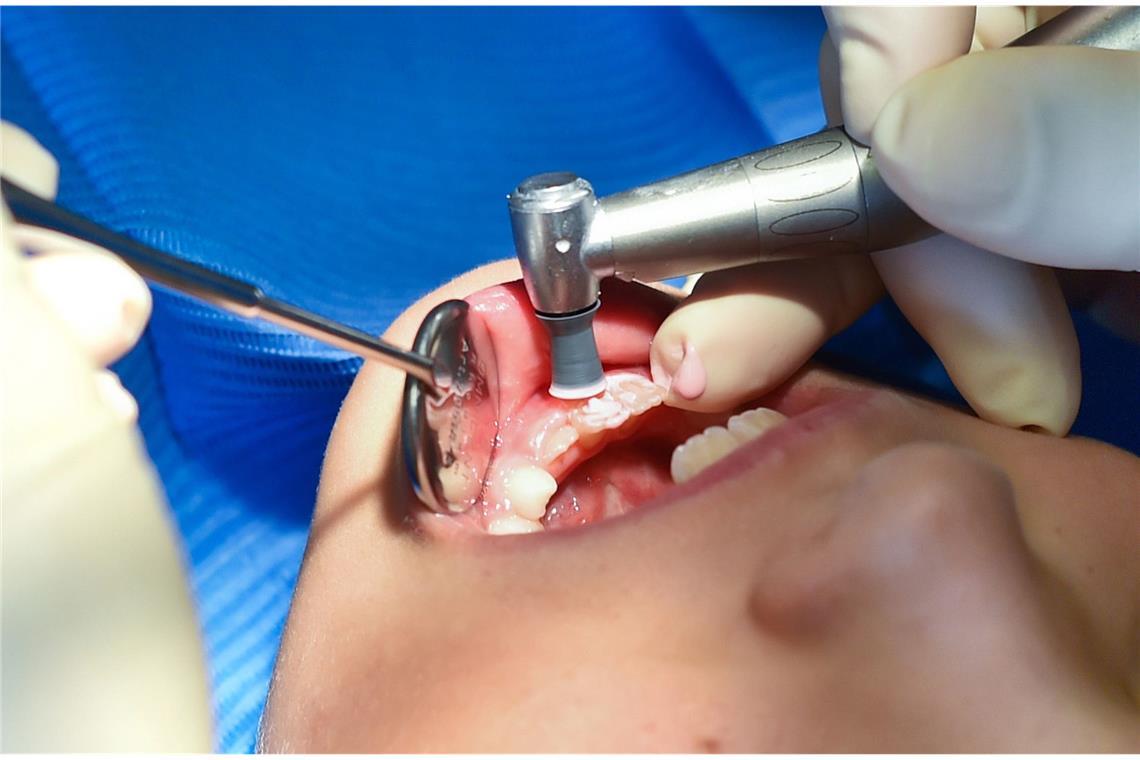 Nicht immer haben Zahnweh-Geplagte die Möglichkeit, sofort einen Zahnarzt aufzusuchen. „In akuten Fällen können Schmerzmittel als Erste-Hilfe-Maßnahme helfen“, sagt Ursula Sellerberg, Sprecherin der Bundesvereinigung Deutscher Apothekerverbände (ABDA).