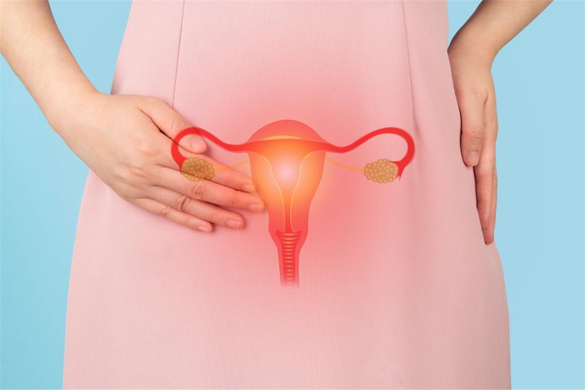 Was ist eine Krebsvorstufe? Oft entwickeln sich die Krebsvorstufen von selbst wieder zurück.
