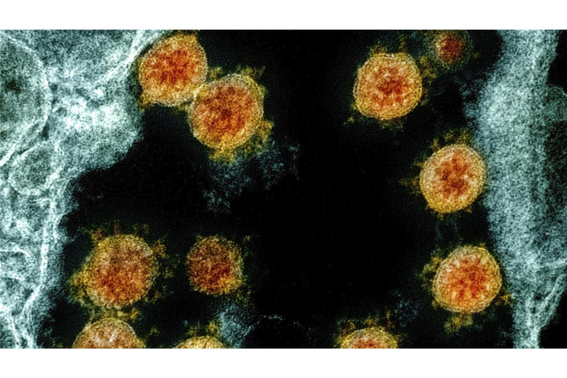 Neue Corona-Welle in asiatischen Ländern Partikel des Coronavirus SARS-CoV-2 unter einem Elektronenmikroskop