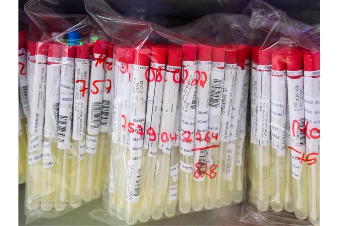 PCR-Tests einem im Labor. Foto: Julian Stratenschulte/dpa