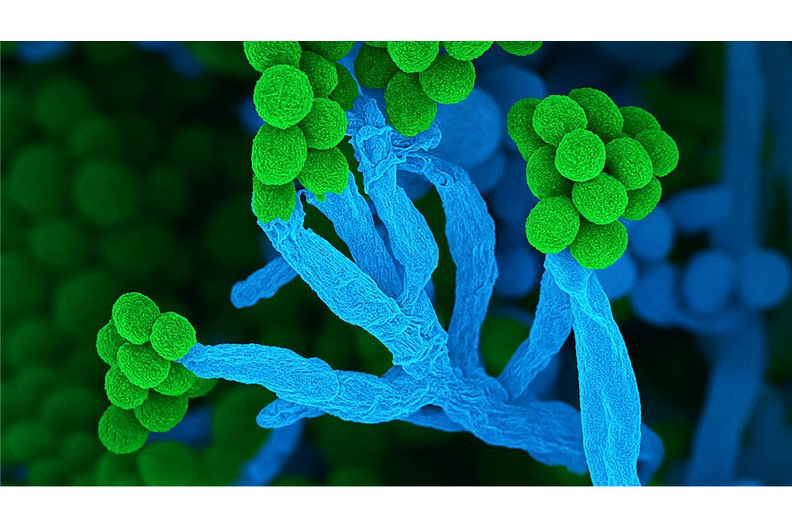 Penicillium bedeutet auf Lateinisch "kleiner Pinsel", weil die Zellketten mit Sporen am Ende so ähnlich aussehen (Handout)