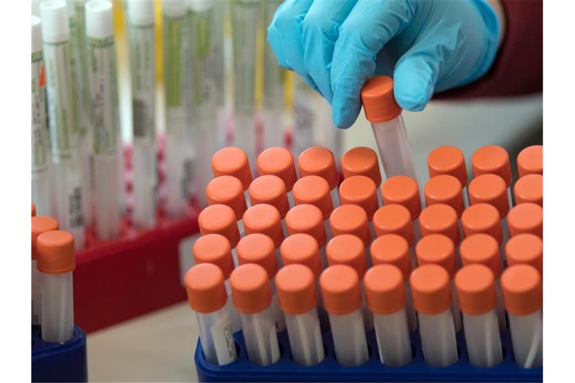 Rund 2400 Menschen neu mit dem Coronavirus infiziert Proben für Corona-Tests werden für die weitere Untersuchung vorbereitet. Foto: Hendrik Schmidt/dpa-Zentralbild/ZB/Symbolbild