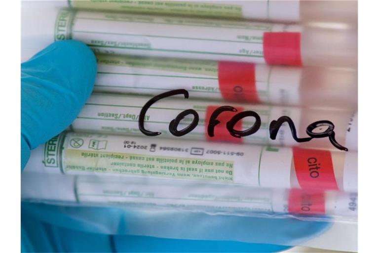 Proben für Corona-Tests werden im Labor für die weitere Untersuchung vorbereitet. Foto: Hendrik Schmidt/dpa-Zentralbild/Symbolbild