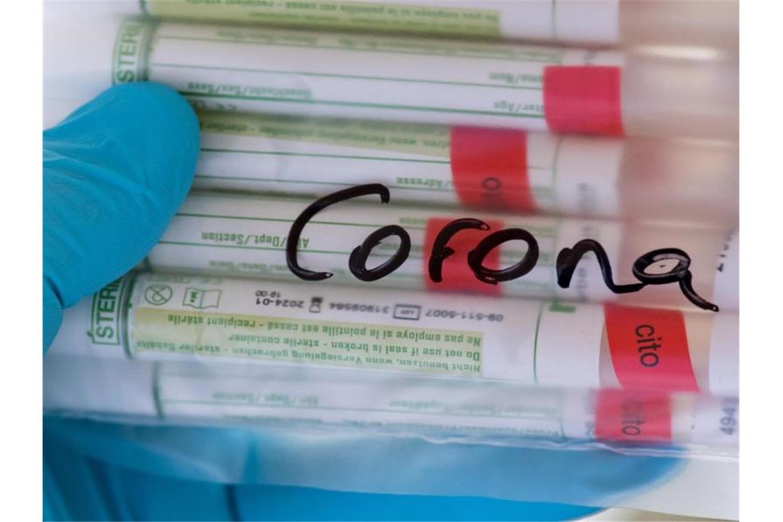 33 962 nachgewiesene Corona-Fälle im Südwesten: 1653 Tote Proben für Corona-Tests werden untersucht. Foto: Hendrik Schmidt/dpa-Zentralbild/ZB/Symbolbild