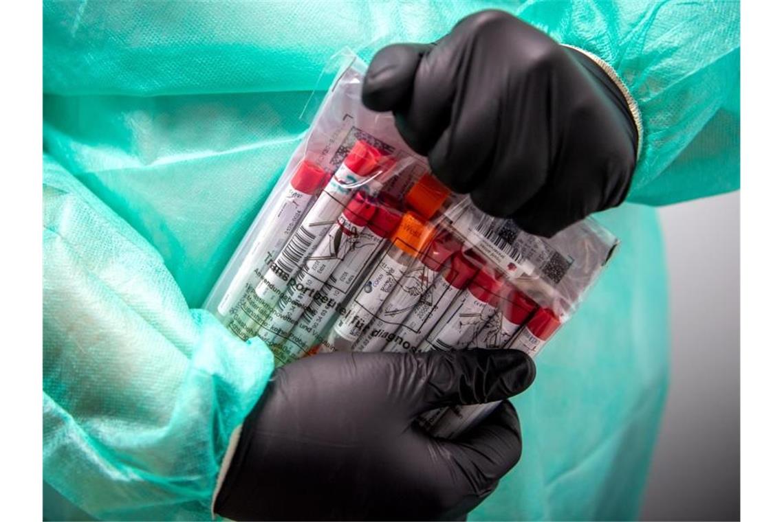 Corona-Inzidenz im Südwesten sinkt Proben für einen PCR-Test werden von einem Laboranten verpackt. Foto: Sina Schuldt/dpa/Symbolbild