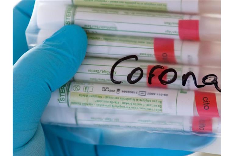 Proben mit Abstrichen werden in einem Labor auf das Coronavirus untersucht. Foto: Hendrik Schmidt/dpa-Zentralbild/ZB