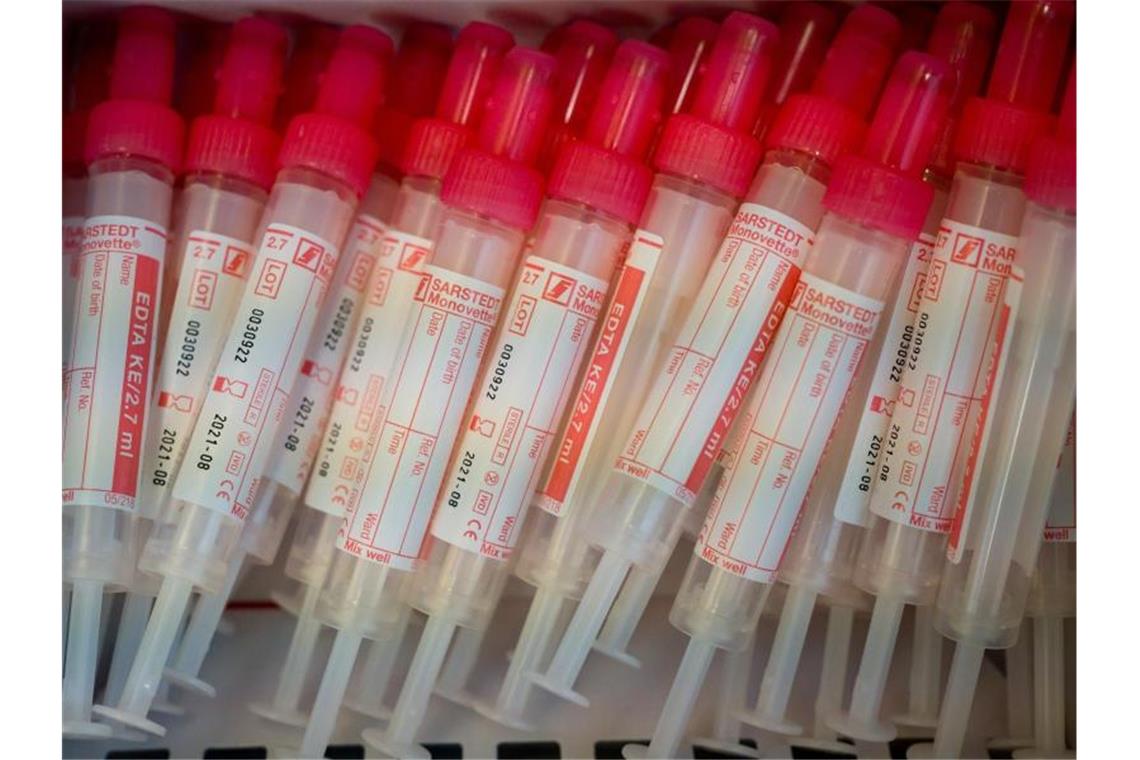 Bayern kündigt Corona-Tests für alle an Proberöhren für die Blutentnahme liegen in einer Verpackung. Jeder soll sich in Bayern auf das Corona-Virus testen lassen können. Foto: Peter Kneffel/dpa