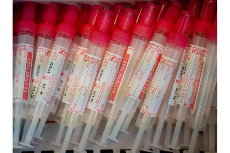 Proberöhren für die Blutentnahme liegen in einer Verpackung. Jeder soll sich in Bayern auf das Corona-Virus testen lassen können. Foto: Peter Kneffel/dpa