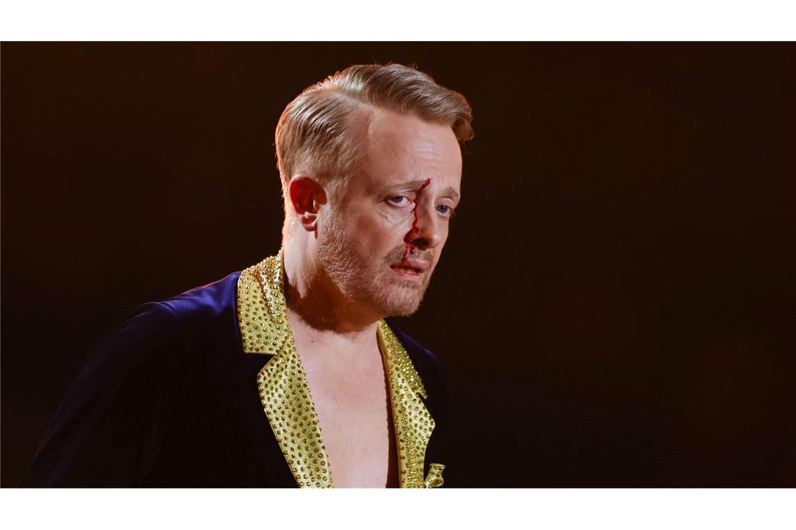 Ross Antony war sichtlich gezeichnet, nahm die Sache aber mit Humor.