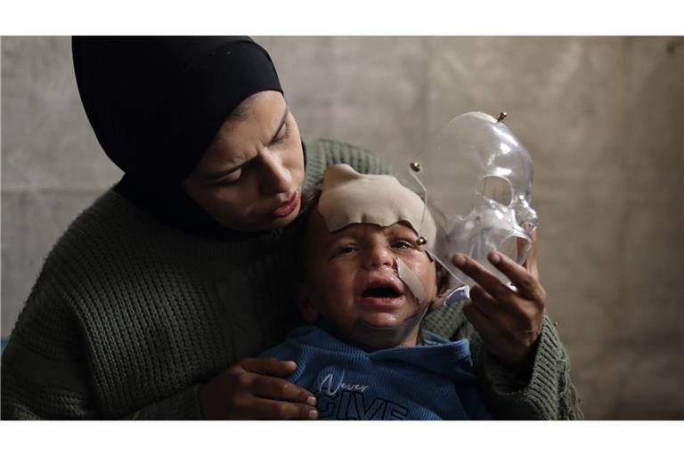 Schwer verletztes palästinensisches Kind im Gazastreifen. Angesichts der katastrophalen Lage in Gaza fordert die israelische Organisation Ärzte für Menschenrechte die Haftentlassung von 14 palästinensischen Ärzten (Archivfoto).
