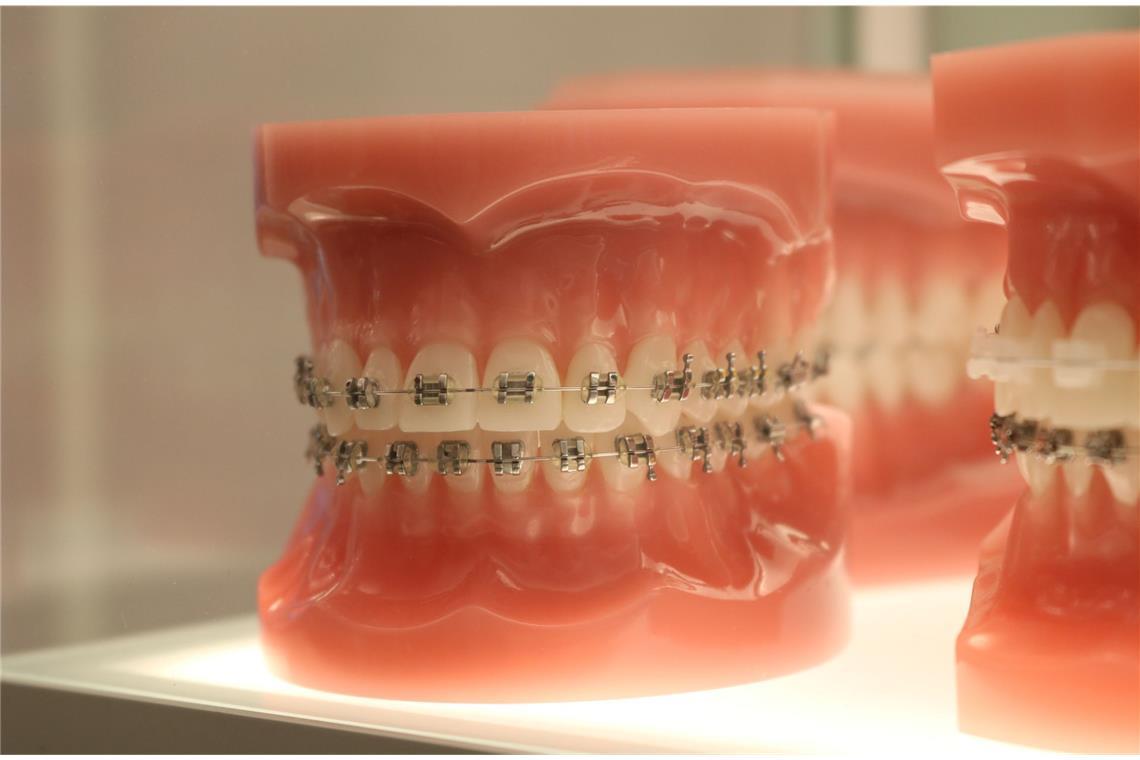 Sind Füllungen oder Kronen im Gebiss beschädigt, dann löst dies ebenfalls heftiges Zahnweh beim Essen aus. Gleiches gilt für Zahnfleischentzündungen.
