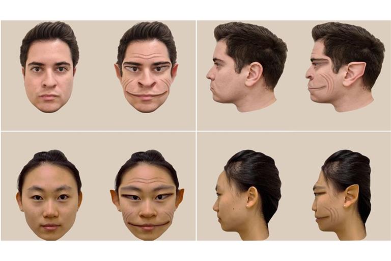 So dämonisch verzerrt nimmt ein 58-jähriger Amerikaner, der an der äußert seltenen Nervenerkrankung Prosopometamorphopsie leidet, die Gesichter anderer Menschen wahr.