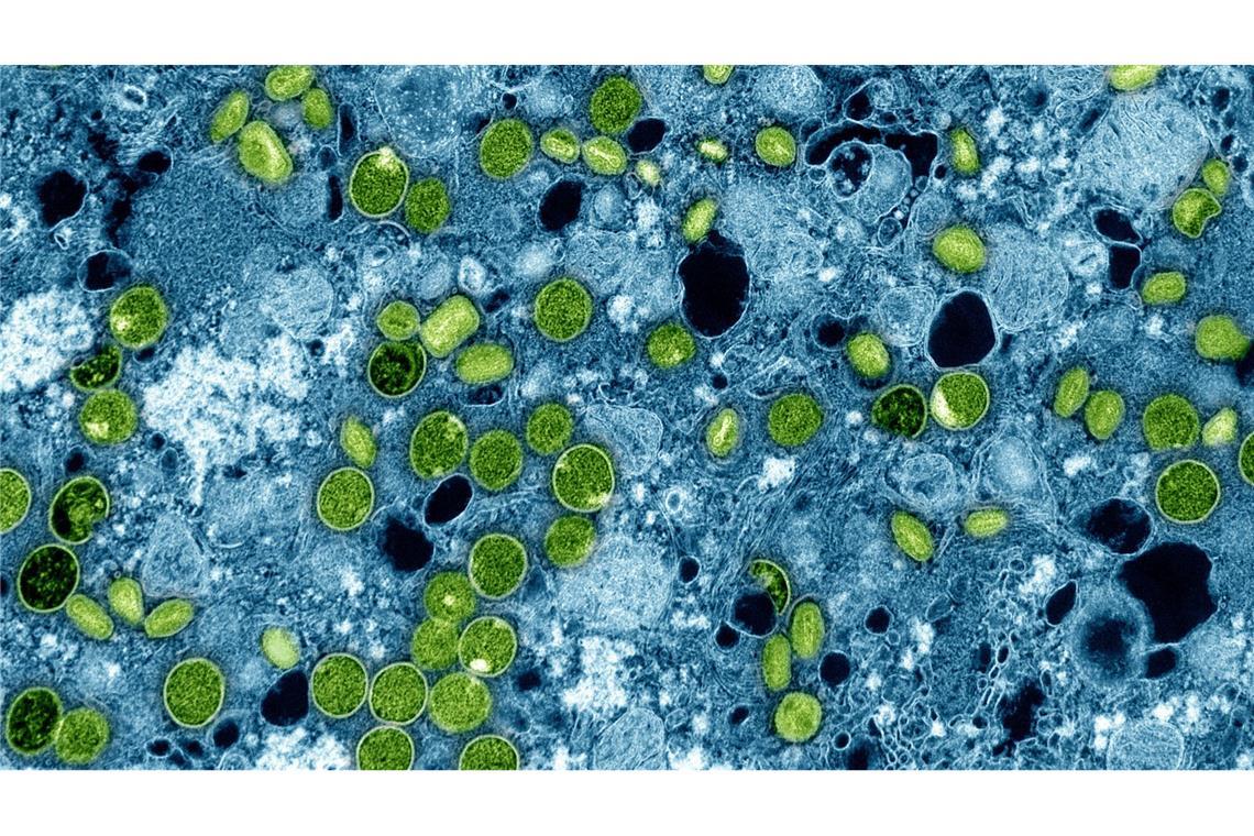 Schulschließung wegen Mpox - Was bedeutet das?