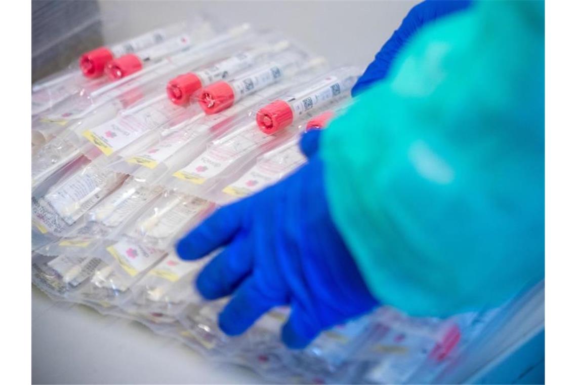 1647 neue Corona-Infektionen in Baden-Württemberg Testsets mit Abstrichstäbchen liegen in einem Testzentrum für Corona-Verdachtsfälle. Foto: Jens Büttner/dpa-Zentralbild/dpa/Archivbild