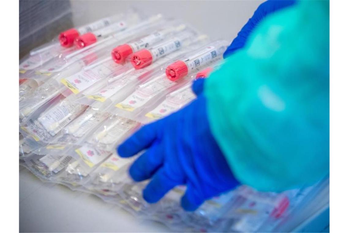2739 neue Corona-Fälle im Südwesten: 46 weitere Tote Testsets mit Abstrichstäbchen liegen in einem Testzentrum für Corona-Verdachtsfälle. Foto: Jens Büttner/dpa-Zentralbild/dpa/Symbolbild
