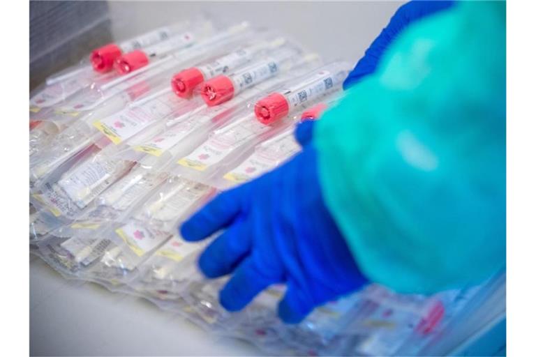 Testsets mit Abstrichstäbchen liegen in einem Testzentrum für Corona-Verdachtsfälle. Foto: Jens Büttner/dpa-Zentralbild/dpa/Symbolbild