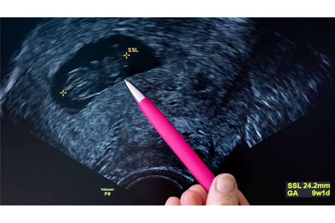 Schwangerschaftsabbruch: Wird Paragraf 218 noch reformiert? Unter bestimmten Umständen werden Abtreibungen innerhalb der ersten zwölf Wochen derzeit nicht bestraft.
