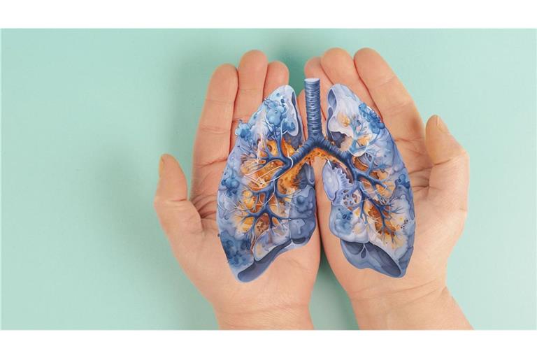 Virale Atemwegsinfektionen wie Grippe oder Covid-19 können gestreute Krebszellen in der Lunge reaktivieren und dadurch die Metastasenbildung fördern.