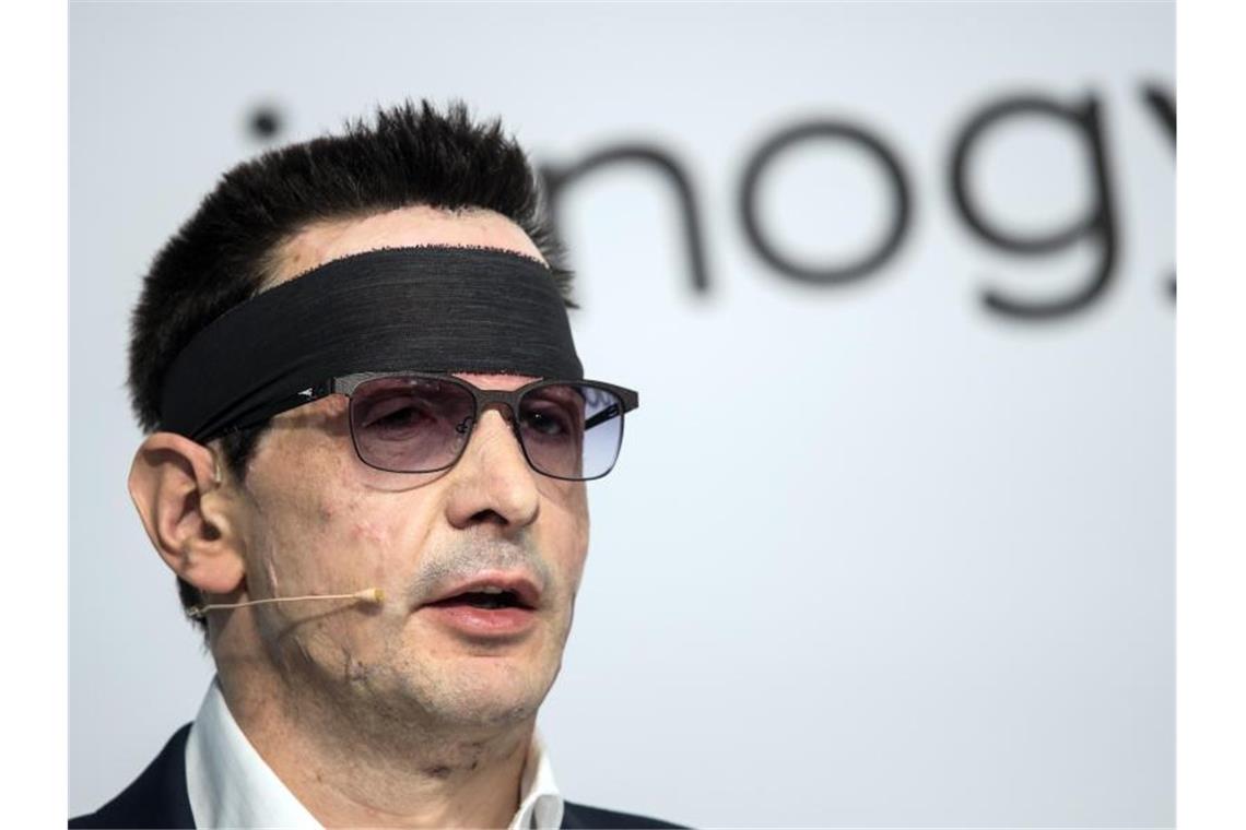 Attackierter Innogy-Manager: Motiv im „beruflichen Umfeld“ Vom Anschlag gezeichnet: Bernhard Günther, Finanzvorstand des Ökostrom-Konzerns Innogy, während der Bilanz-Pressekonferenz. Foto: Federico Gambarini/dpa