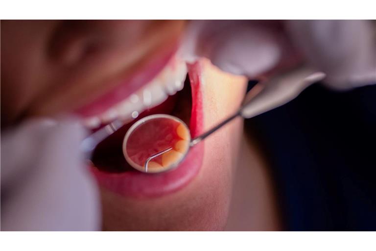 Zahnarztbehandlungen sollen nach dem Willen des CDU-Wirtschaftsrats "nicht länger im Umlageverfahren den Beitragszahlern zur Last fallen". (Symbolbild)