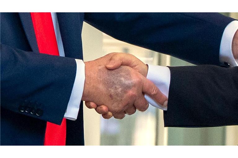 Zu sehen beim Händedruck mit dem südkoreanischen Präsidenten Lee: ein Bluterguss auf Trumps rechter Hand.