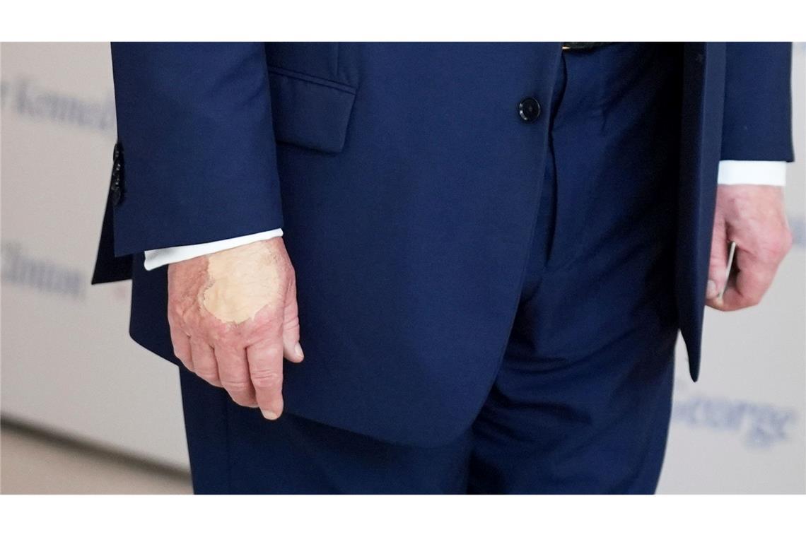 Zuvor zeigten Fotos den Bluterguss offenbar mit Make-up überschminkt. (Archivbild)